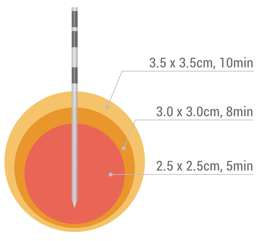Dophi&trade;-M150E-Spherical-Ablation.1